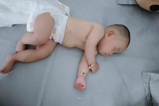 沅江宝宝脸上有白色斑块